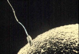 Spermatozoid